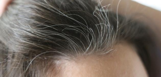 The appearance of gray hair at an early age