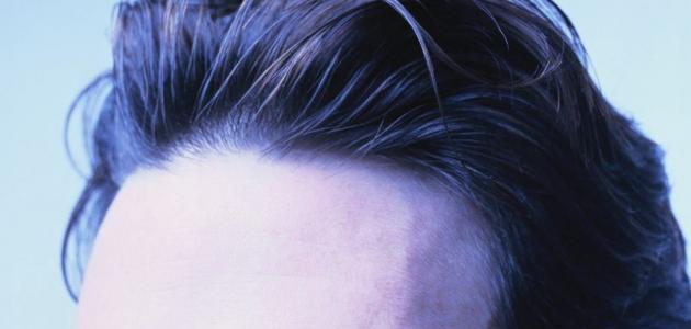 Hair loss treatment from the front of the head