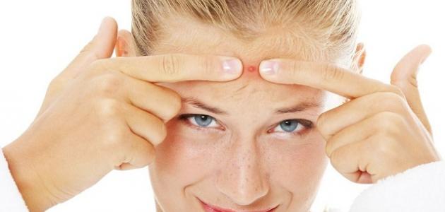 Comment se débarrasser définitivement de l'acné chez les adolescents