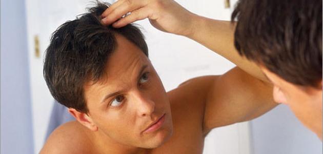 How to keep your hair from falling out for men