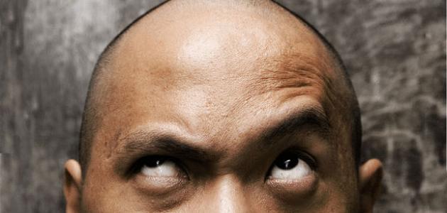 How to keep your hair from baldness