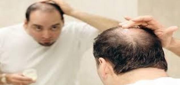 How to prevent hair fall