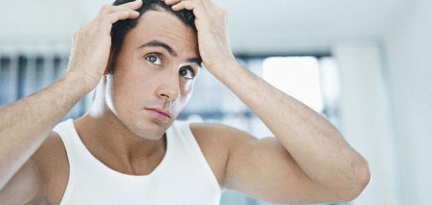 حل مشكلة تساقط الشعر عند الرجال