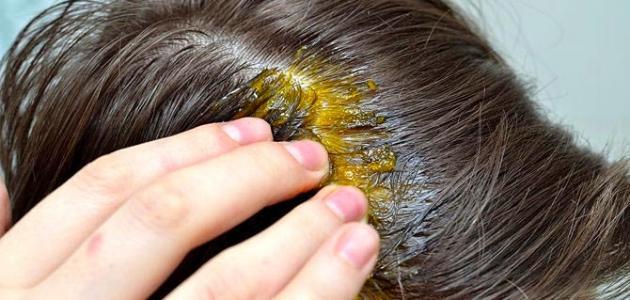طريقة للقضاء على حشرات الشعر