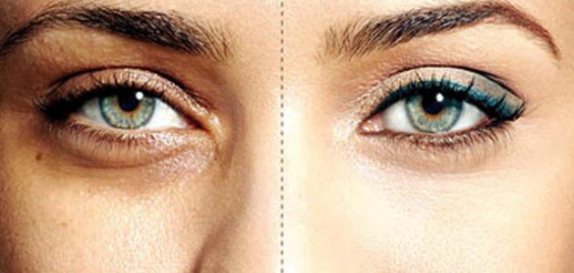 Treatment of blackness around the eye