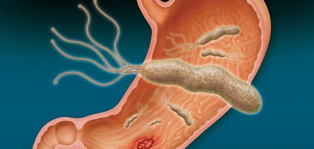 Симптомы микробов желудка и толстой кишки