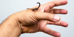 What is the treatment for a scorpion sting?